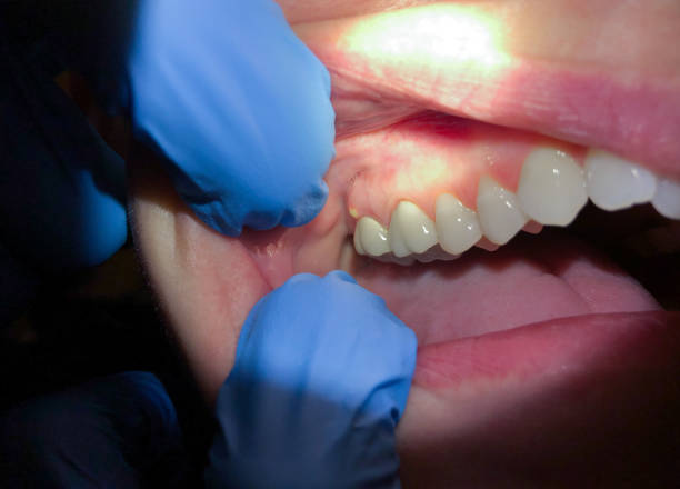 Best Emergency Dental Care for Trauma or Injury in Collinsville, AL