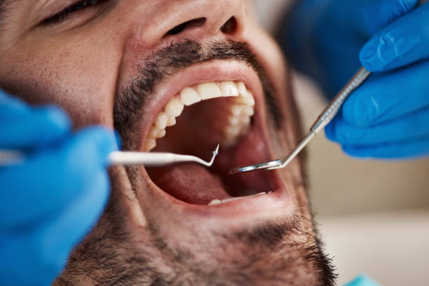 Best After-Hours Emergency Dentist in Collinsville, AL