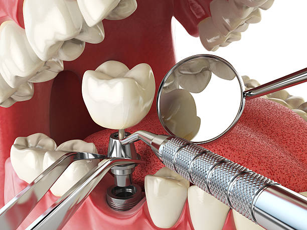 Best Emergency Broken Tooth Repair in Collinsville, AL